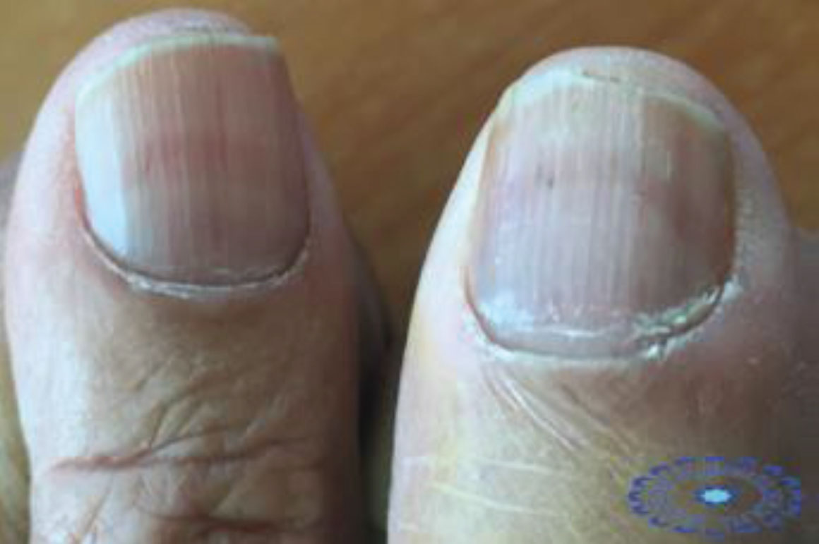 Nails are often thought of for their... - Aurora Health Care | Facebook