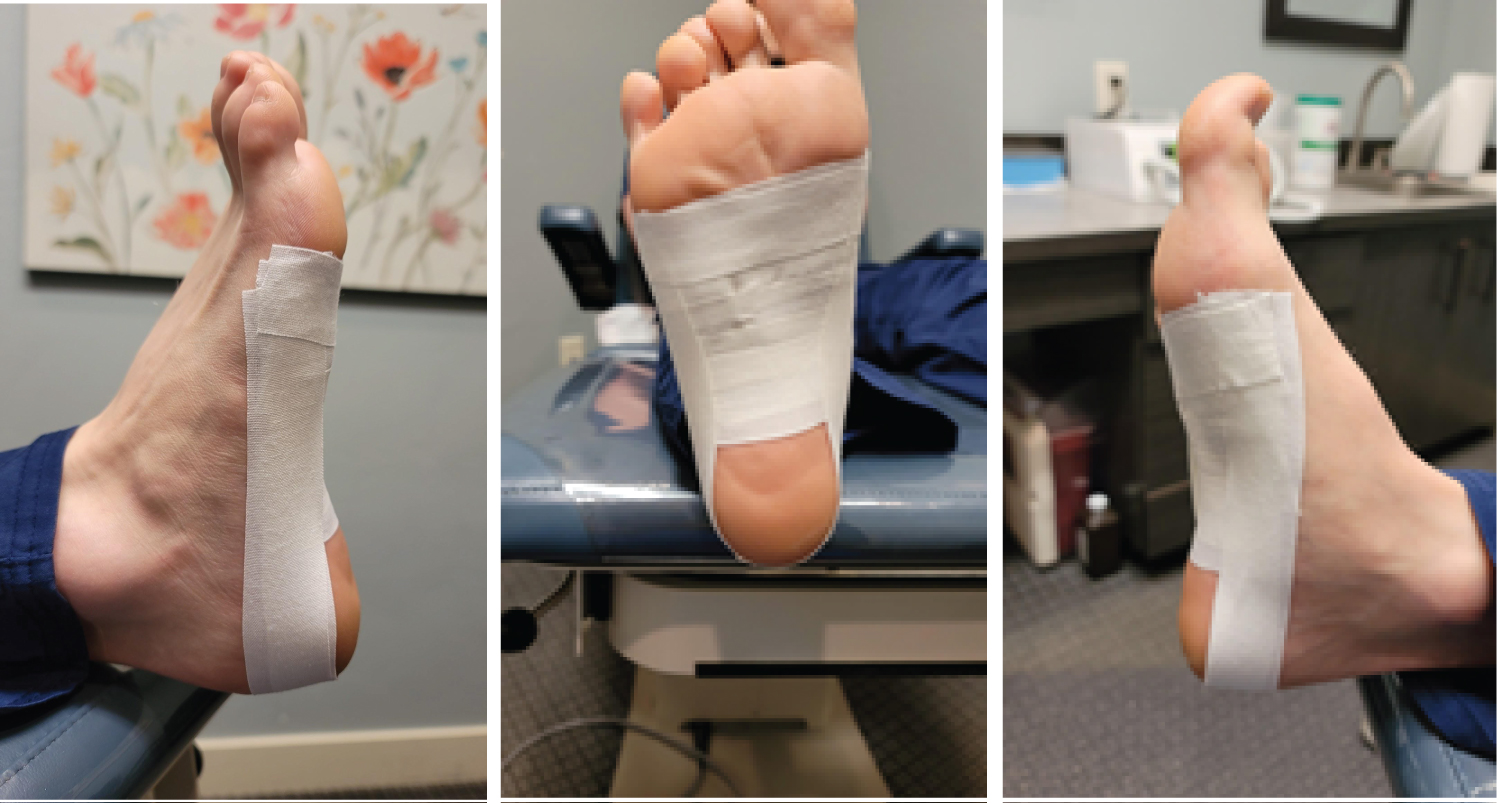 Is Athletic Tape Effective? - MASS4D® Foot Orthotics