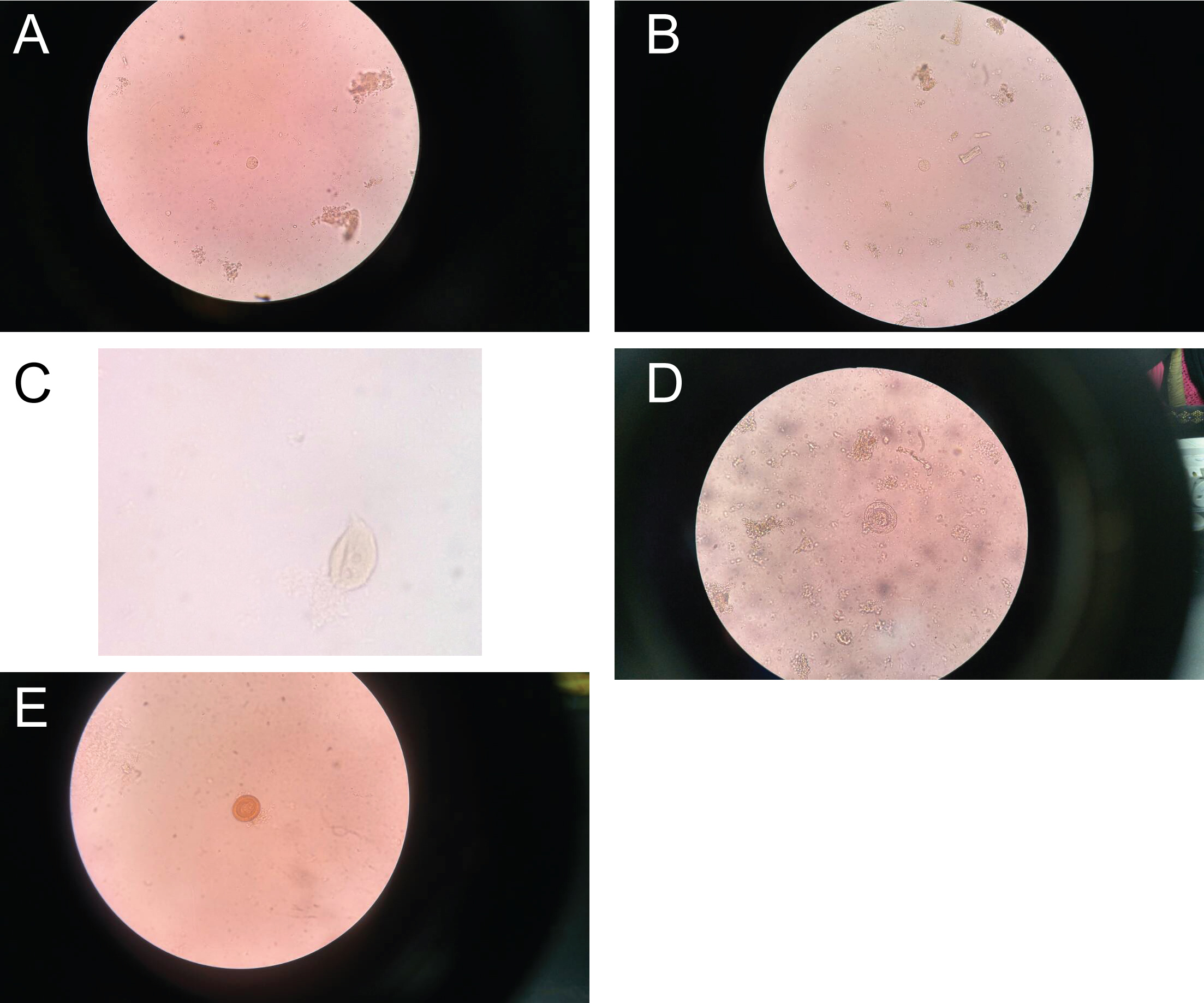 To Nine Hidden Stare Detection of Intestinal Parasites Transmitted Mechanically by House Flies  (Musca domestica, Diptera: Muscidae) Infesting Slaughterhouses in Khartoum  State, Sudan